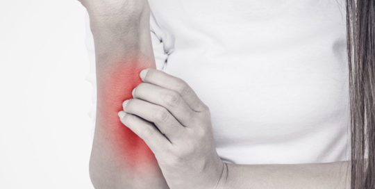 Cure artrite psoriasica | Atlantic terme natural Spa & Hotel